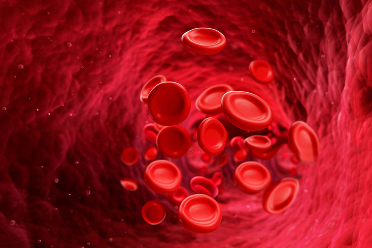 تفاوت کم‌خونی و کمبود آهن